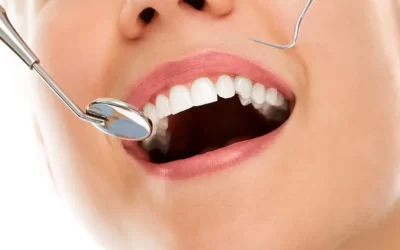 Saúde bucal: Cuidado com os dentes é fundamental