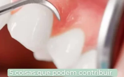 5 coisas que podem contribuir para a saúde da sua gengiva
