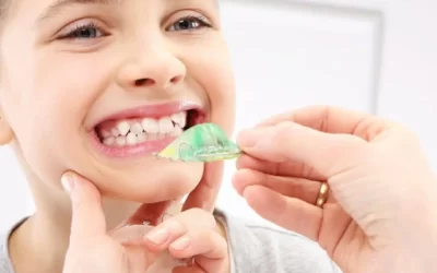 Aparelho só pode ser usado em dentes permanentes?