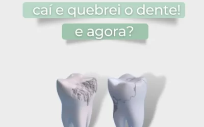 Caí e quebrei o dente. E agora?