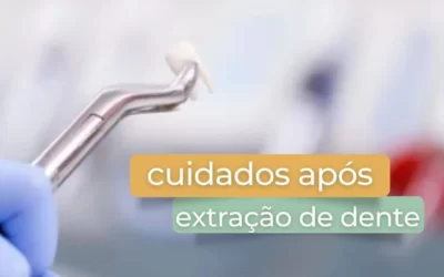 Cuidados após extração de dente