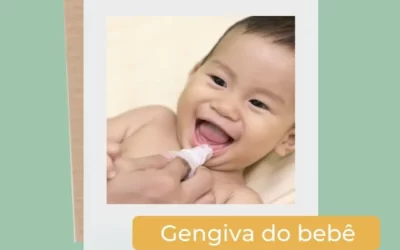 Gengiva do bebê precisa ser higienizada?Gengiva do bebê precisa ser higienizada?Gengiva do bebê precisa ser higienizada?