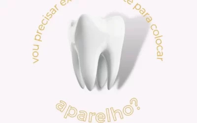 Vou precisar extrair o dente para colocar aparelho?