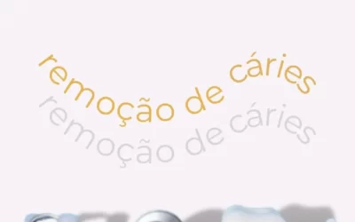 Remoção de cáries