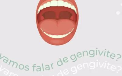 Sintomas da Gengivite
