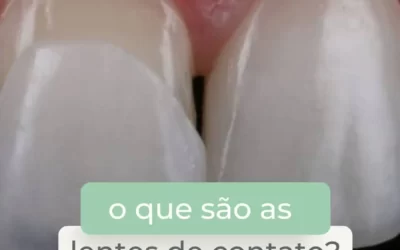O que são as Lentes de Contato?