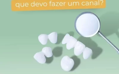 Toda dor de dente significa que devo fazer um canal?