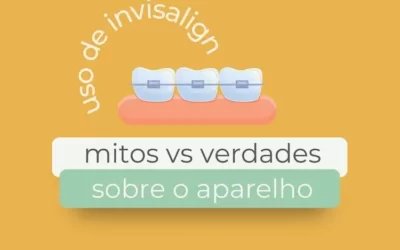 Uso de Invasalign: mitos vs verdades sobre o aparelho