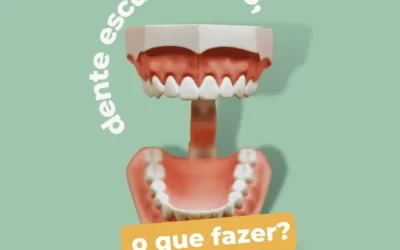 Dente escurecendo, o que deve-se fazer?