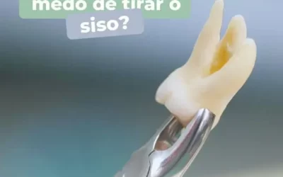 Você tem medo de tirar o siso?