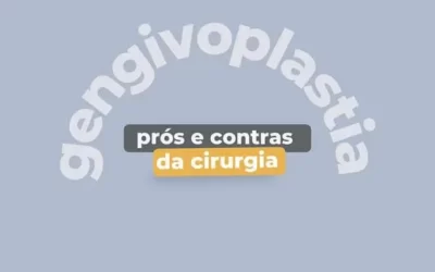 Prós e contras da cirurgia: Gengivoplastia
