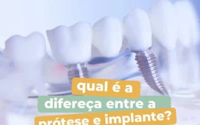 Saiba qual é a diferença entre a prótese e implante