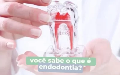 Você sabe o que é Endodontia