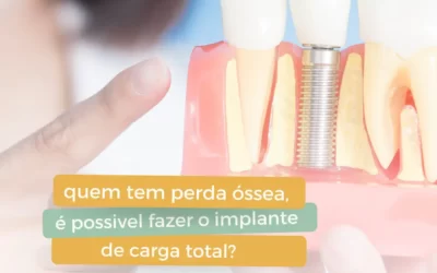 Quem tem perda óssea pode fazer o implante de carga total?